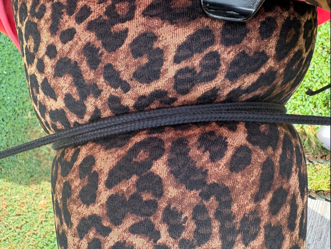 Eingeschnürtes Bein – Lipödem Leggings dürfen nicht zu eng sein